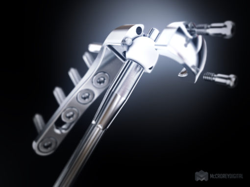 Medical Device